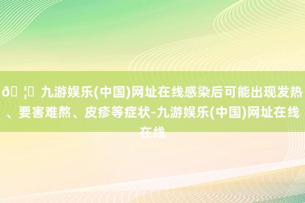 🦄九游娱乐(中国)网址在线感染后可能出现发热、要害难熬、皮疹等症状-九游娱乐(中国)网址在线